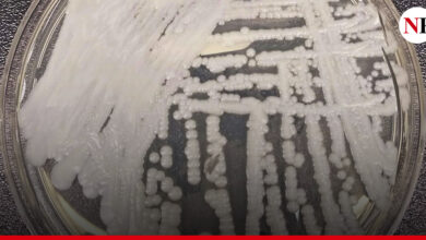 Photo of SÚPER HONGO: LA ENFERMEDAD QUE PODRÍA CONVERTIRSE EN LA PRÓXIMA PANDEMIA
