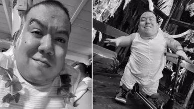 Photo of Muere el influencer colombiano ‘Alejo Little’, símbolo de resiliencia en redes