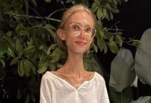 Photo of Influencer muere en Bali y reabre debate sobre dietas extremas