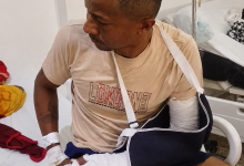 Photo of Hombre podría perder un brazo tras ataque con machete en Lorica